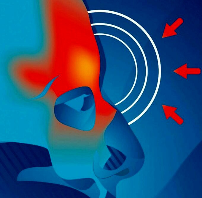 Kann Ein Luftbefeuchter Bei Sinusitis Helfen Jetzt Kopfschmerzen Stoppen